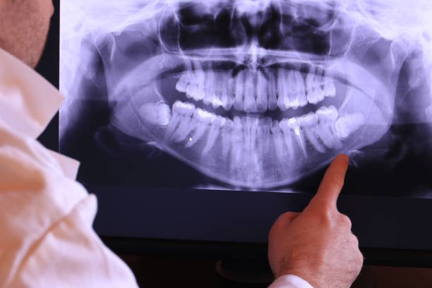 Best Weekend Emergency Dentist in Penryn, CA