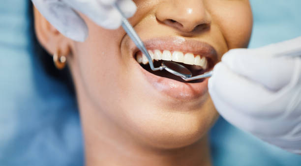 Best Emergency Treatment for Dental Infections or Abscesses in Penryn, CA